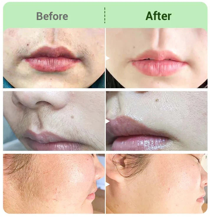 🎅New Year Sale 49% OFF🤩Hair Removal Cream Kit for Women