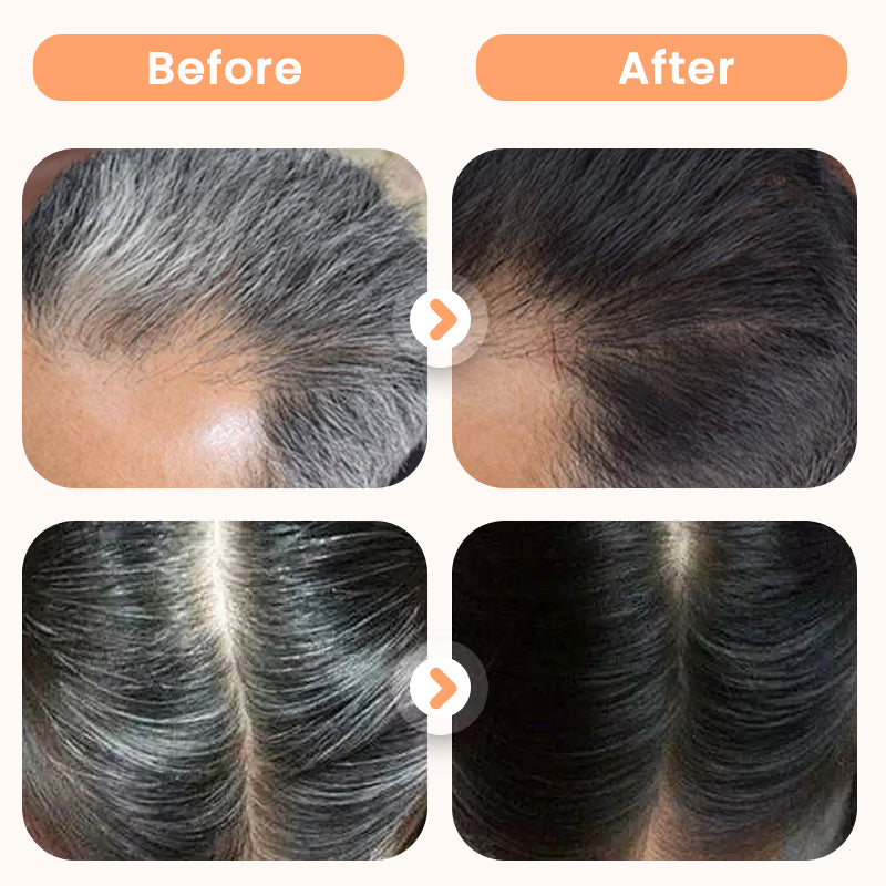 💆♀️🌿 Teinture Capillaire aux Extraits Végétaux pour Cheveux Blancs