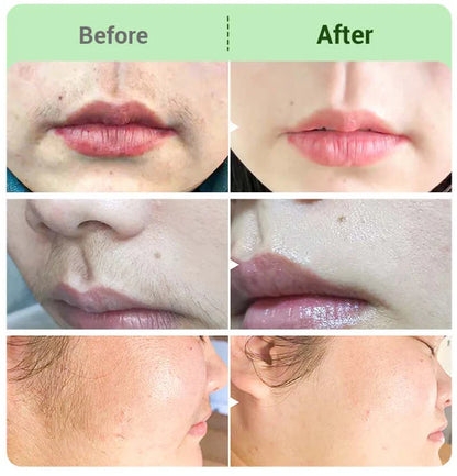 🎅New Year Sale 49% OFF🤩Hair Removal Cream Kit for Women